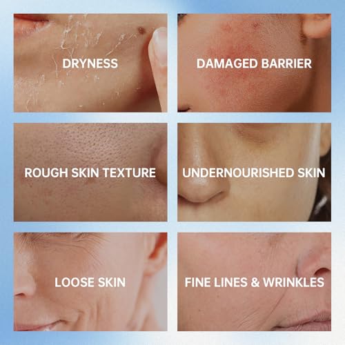 VGO Snail Mucin 92% Moisturizer Daily Face Moisturizer Hydrating Repair Face Gel Cream for Dry & Sensitive Skin, All Skin Types 50g / 1.76oz