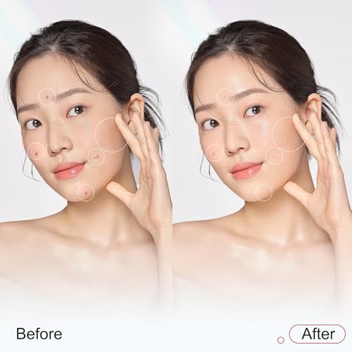 ZMbeauty Niacinamide Serum 10%, 377 1% Dark Spot Corrector, Vitamin C Face Serum for Uneven Skin Tone, Pores Reducer, Facial Soothing Moisturizer, Korean Skin Care 30ml/1.01 fl. oz