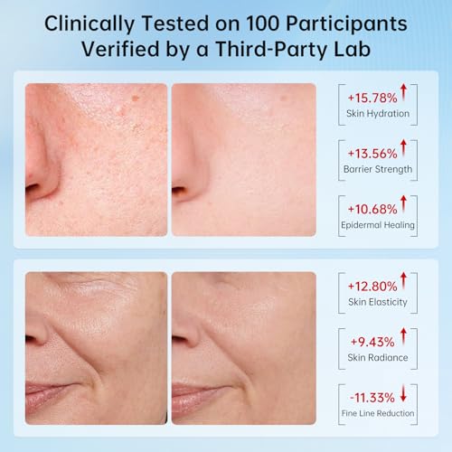 VGO Snail Mucin 92% Moisturizer Daily Face Moisturizer Hydrating Repair Face Gel Cream for Dry & Sensitive Skin, All Skin Types 50g / 1.76oz