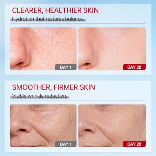 VGO Snail Mucin 92% Moisturizer Daily Face Moisturizer Hydrating Repair Face Gel Cream for Dry & Sensitive Skin, All Skin Types 50g / 1.76oz