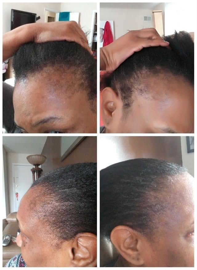 Kreyol Essence - Haitian Black Castor Oil for Skin and Hair, Glass Bottle - Cold Pressed Castor oil, Fuller-Looking Hair, Hexane Free, Natural Humectant