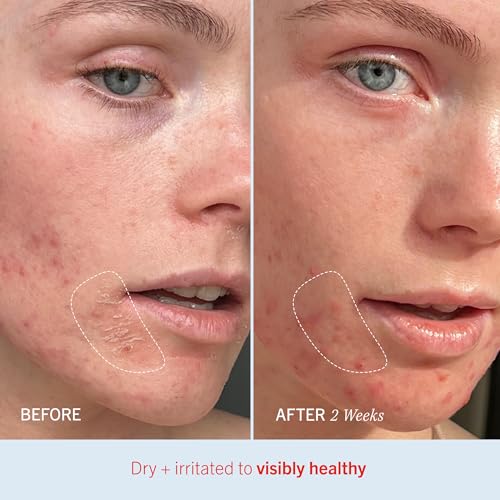 First Aid Beauty - Ultra Repair Cream, Intense Hydration Whipped Colloidal Oatmeal, Clinically Proven to Strengthen Skin Barrier in 7 Days & Helps Relieve Eczema, Luxury Face & Body Moisturizer, 2 oz