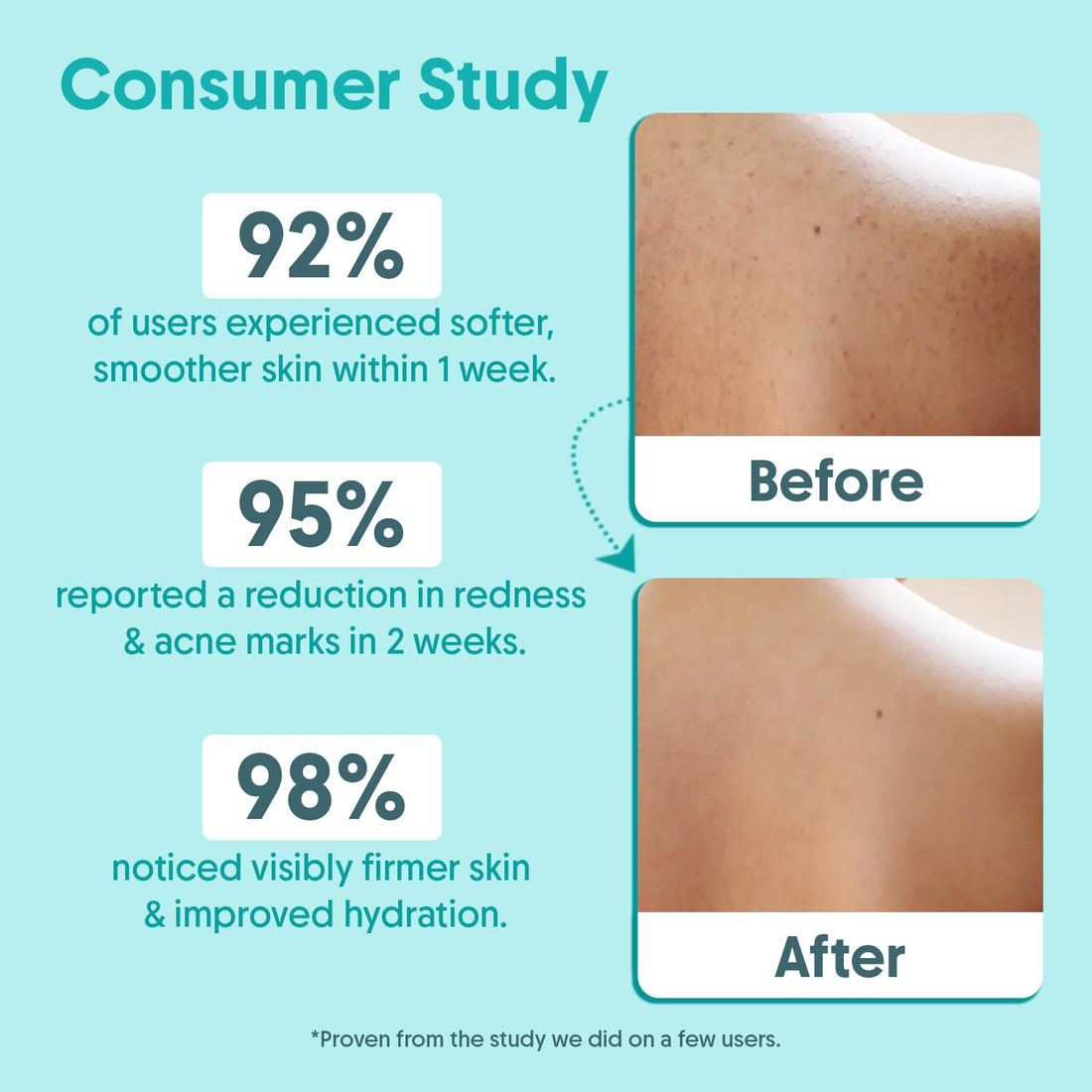 Aravi Organic 2% Salicylic Acid Exfoliating Body Wash with Niacinamide & Blueberry - Prevents Body Acne, Dead Cells, Deep Cleanses & Odor Defense - All Skin Types - SLS & Paraben Free - 300 ml
