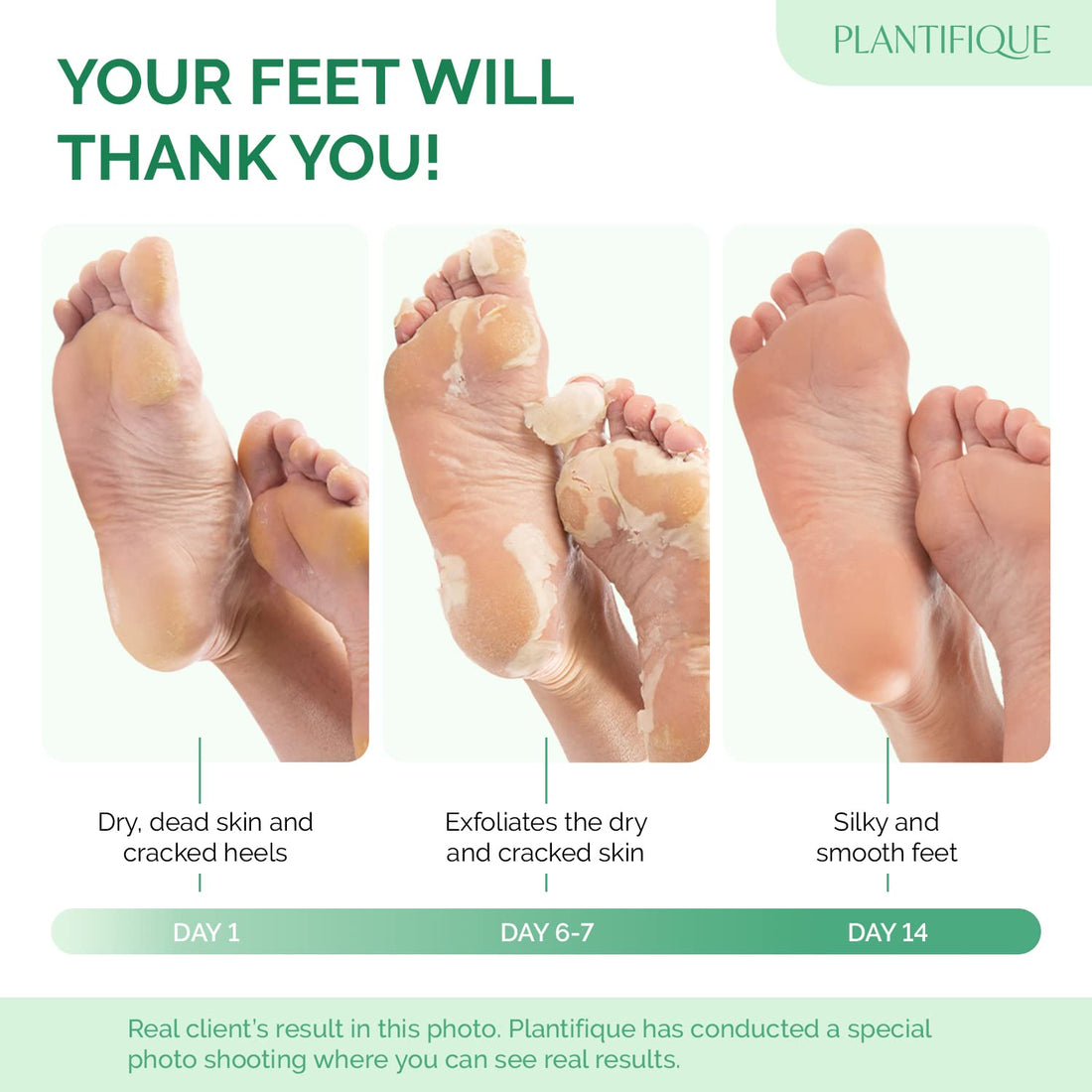 Plantifique Cosmety Paris Exfoliating Foot Peeling Mask for Soft Baby Feet - 2 Pairs - Removes Calluses, Dead and Dry Skin - Repairs Rough Heels In 7 Days; for Men and Women; Natural Gel Socks Booties