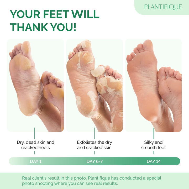 Plantifique Cosmety Paris Exfoliating Foot Peeling Mask for Soft Baby Feet - 2 Pairs - Removes Calluses, Dead and Dry Skin - Repairs Rough Heels In 7 Days; for Men and Women; Natural Gel Socks Booties