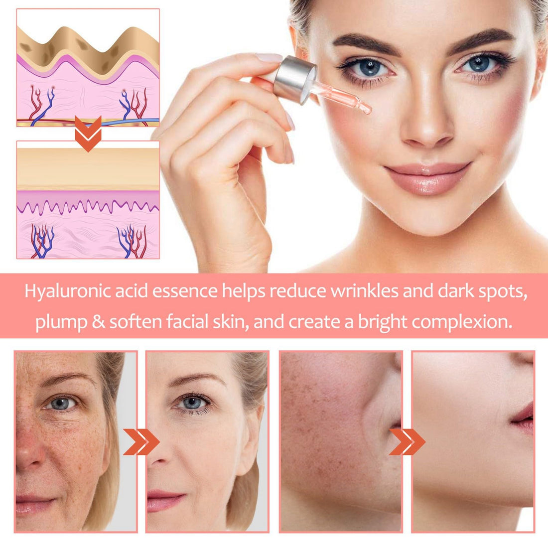 Vitamin C Face Serum, 5 In 1 Anti Aging Serum With Vitamin C, Vitamin E, Hyaluronic Acid, Collagen and Nicotinamide, Vitamin C Serum For Facial Moisturizing, Firming Skin And Even Skin Tone 30ml