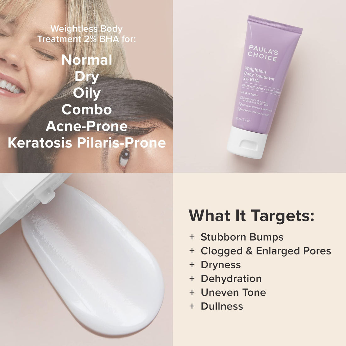 Paula's Choice Weightless Body Treatment 2% BHA, Salicylic Acid & Chamomile Lotion Exfoliant, Moisturizer for Keratosis Pilaris (KP) Prone Skin & Clogged Pores, Fragrance-Free & Paraben-Free