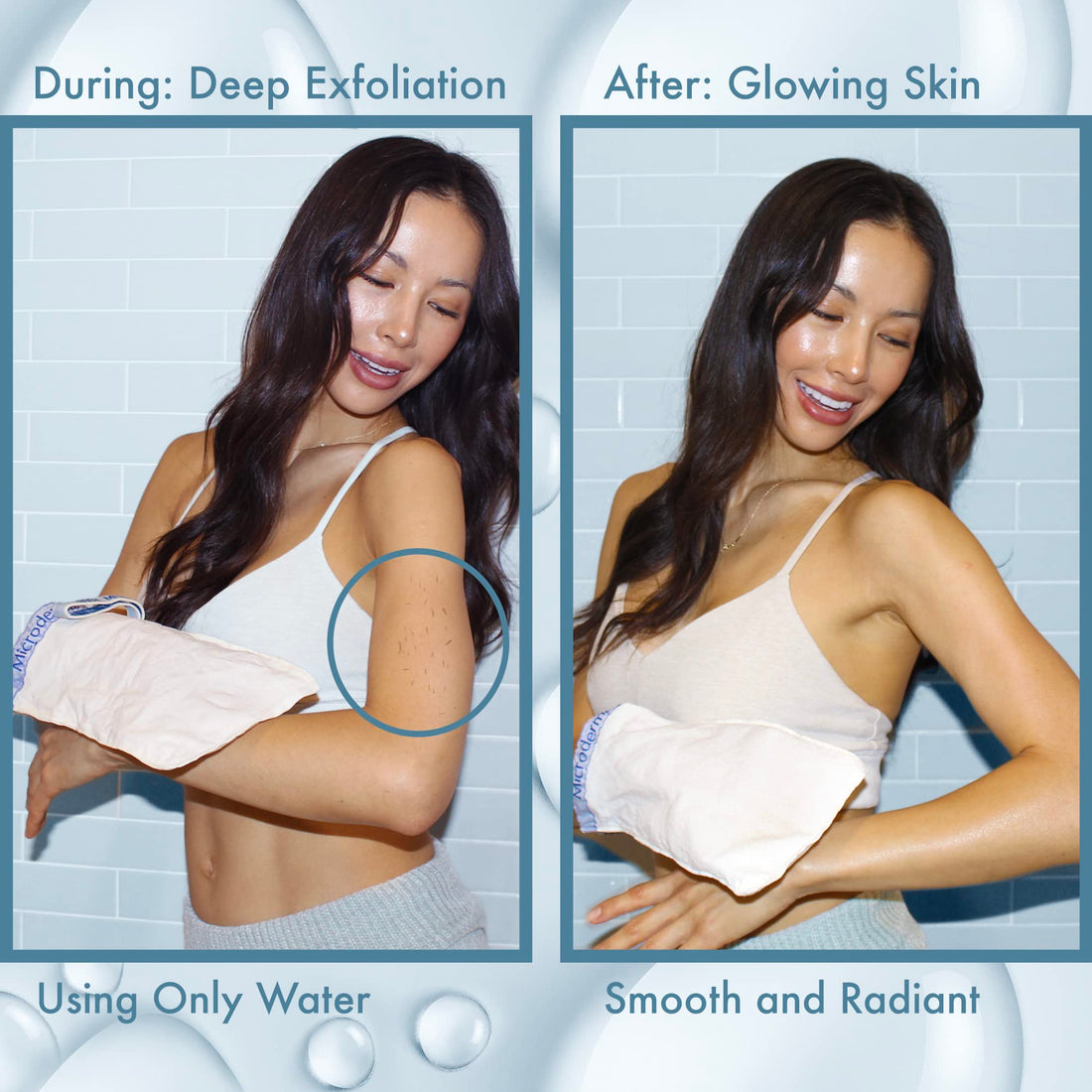 MicrodermaMitt Deep Exfoliating Mitt for Shower – Dead Skin Remover & Exfoliator Body Scrubber - Keratosis Pilaris – Premium Quality for Smooth & Cleaner Skin Quickly - Feels Good on Skin - No Dyes