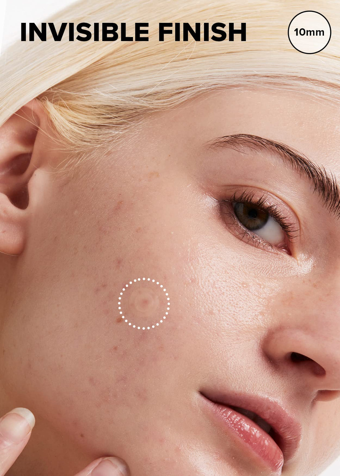 I DEW CARE Hydrocolloid Acne Pimple Patch - Timeout Blemish Original | Korean Zit Dark Spot Patches for Face and Skin, Pus absorbing with Tea Tree Oil, Mother's Day, 36 Count