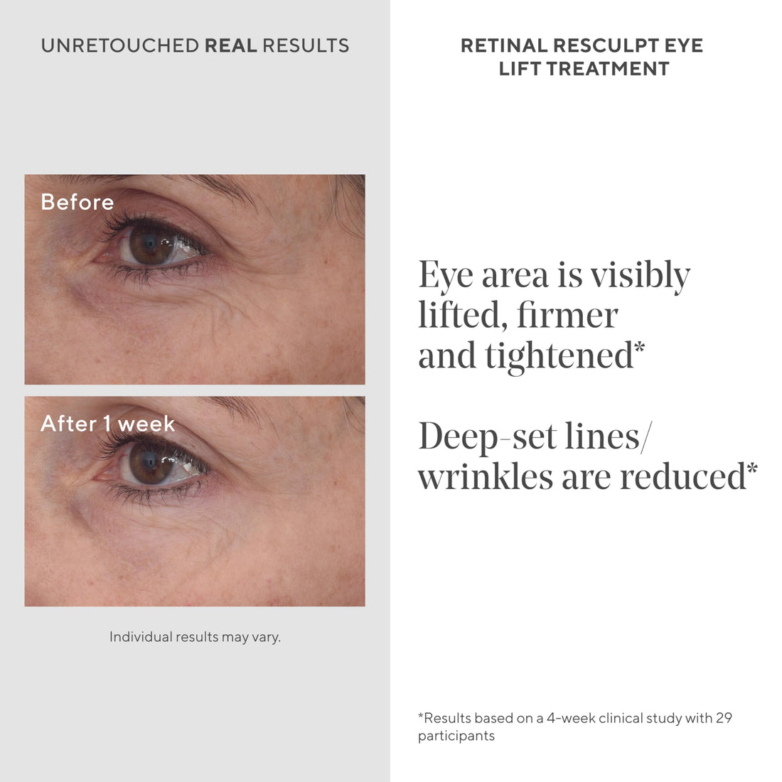 Murad Retinal ReSculpt Eye Lift Treatment - Anti-Aging Eye Cream Lifts and Improves Sagging - Encapsulated Vitamin A Eye Care Firms Droopy Eyelids, Reduces Lines and Wrinkles - 0.5 FL OZ
