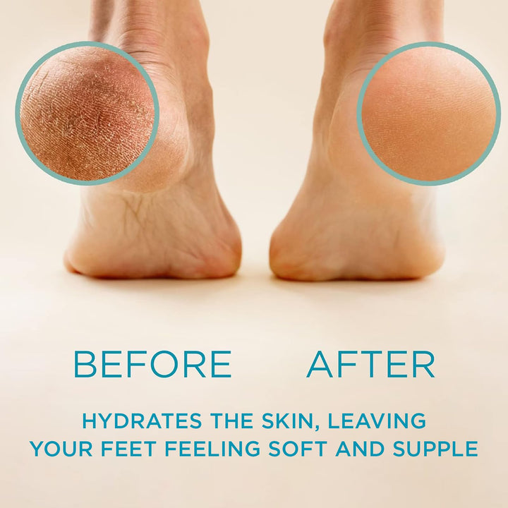 16oz Best Callus Remover.Callus Eliminator,Liquid & Gel For Corn And Callus On Feet. Professional Grade, Does Better Job Than Electric Shaver&Other Scary Tools
