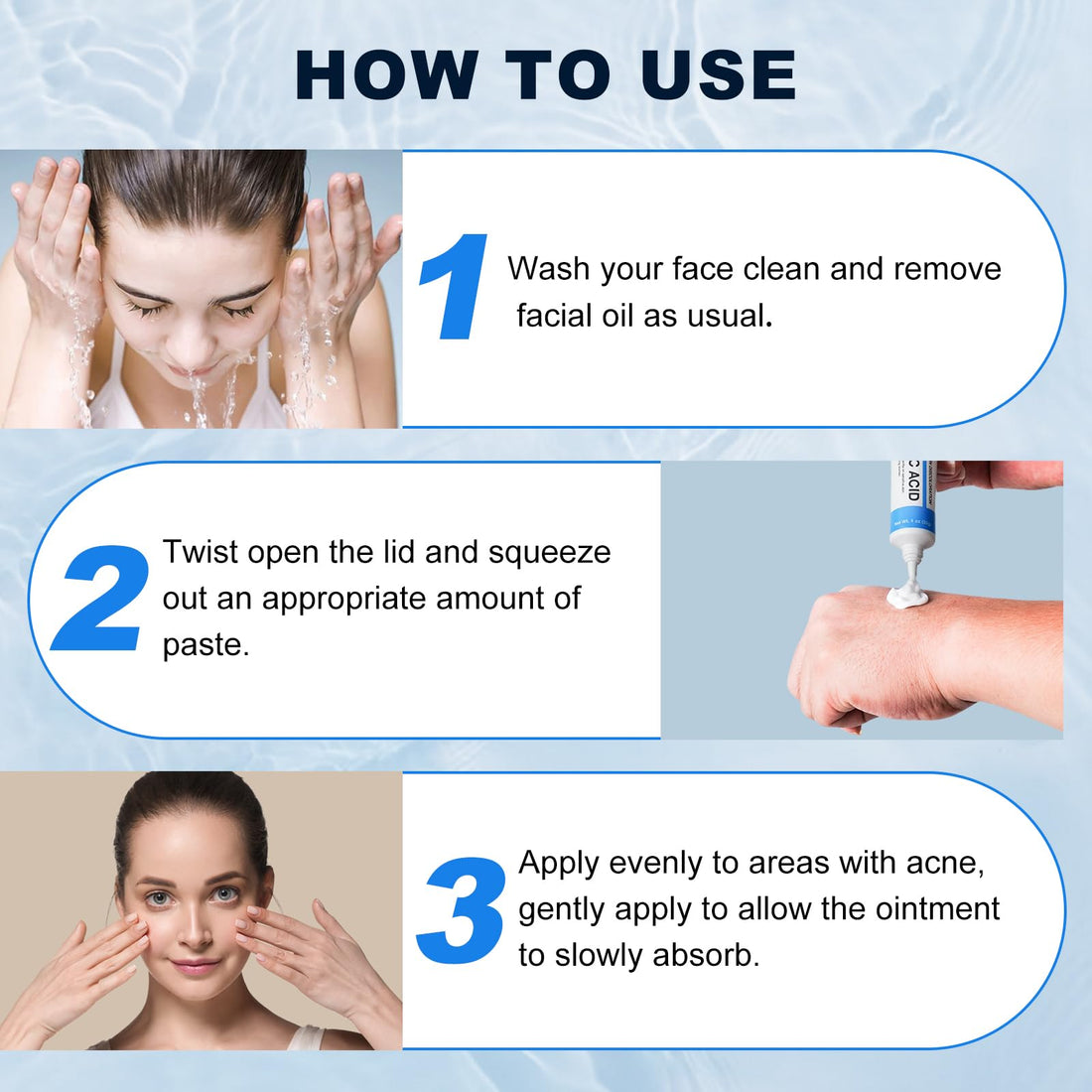 Azelaic Acid 10% Cream for Face - Acne Cream for Rosacea Reducing Relief Pimple Breakouts Blackhead Pigmentation and Redness - Azelaic Acid Gel For Facial and Skin Care