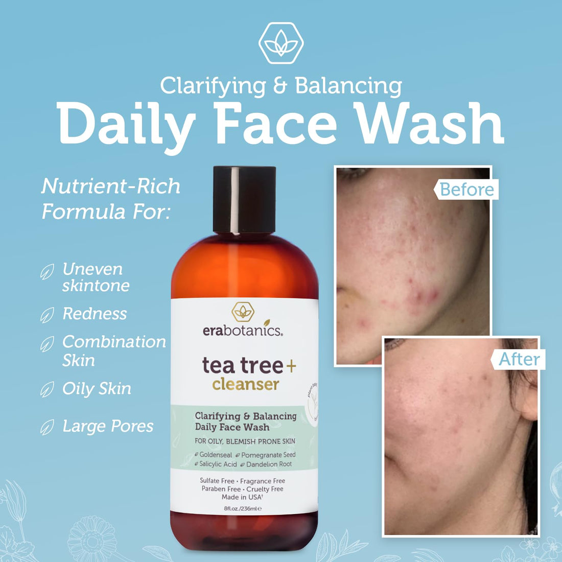 Tea Tree Oil Face Cleanser & Body Wash for Dry, Oily, Acne Prone Skin & Rosacea 8oz Natural & Organic Facial Wash to Moisturize, Nourish, Soothe Redness & Inflammation