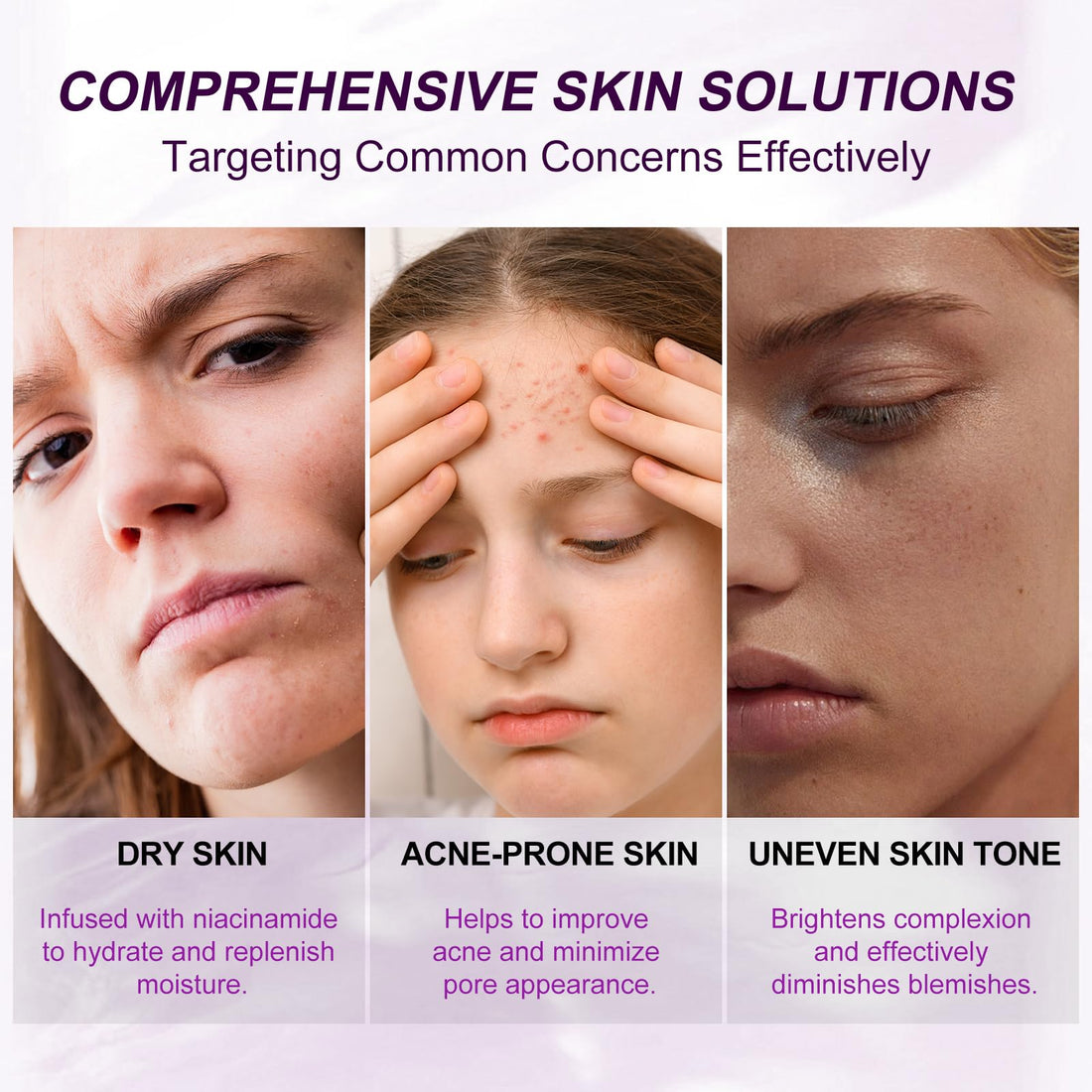 Marianp Hyaluronic Acid Serum for Face- Azelaic Acid 10% Serum for Facial And Skin Care Treatment with Vitamin B3 And B5 for Acne Pimple Pigmentation Blackhead Rosacea Beauty Skincare