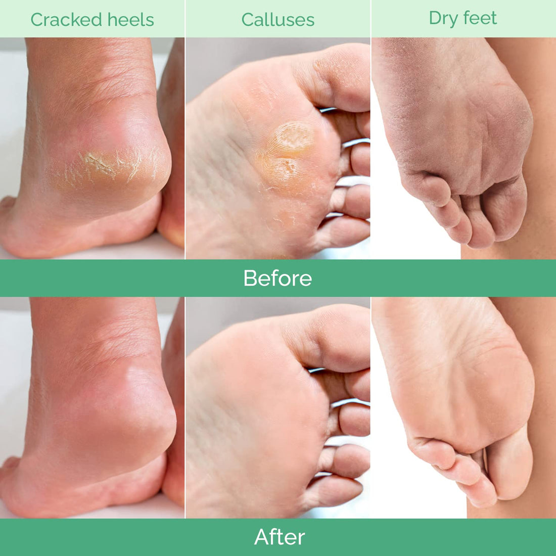 Plantifique Cosmety Paris Exfoliating Foot Peeling Mask for Soft Baby Feet - 2 Pairs - Removes Calluses, Dead and Dry Skin - Repairs Rough Heels In 7 Days; for Men and Women; Natural Gel Socks Booties