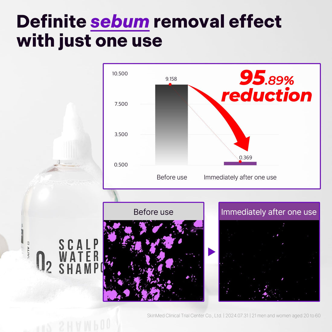 ALIVELAB O2 Scalp Water Shampoo, Water-like Deep Cleansing and Soothing Hair Care for Itchy Sensitive Scalp (11.83 fl.oz)