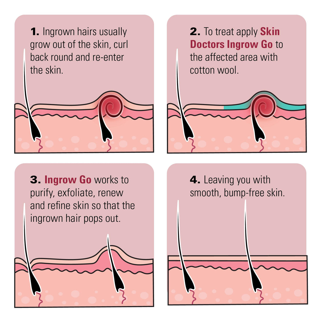 Skin Doctors Ingrow Go Ingrown Hair Lotion 120mls