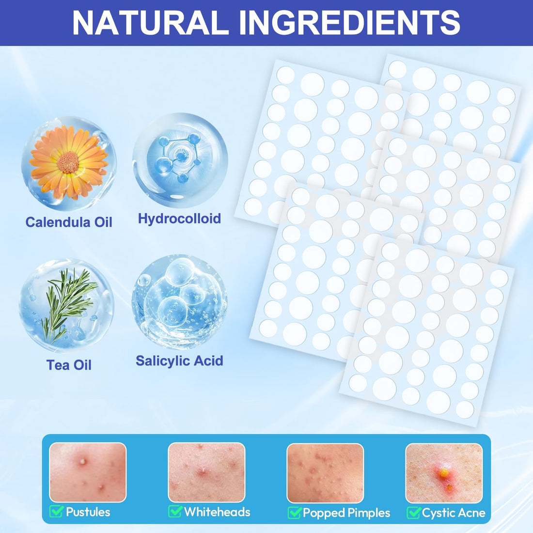 Pimple Patches for Face, 288 Hydrocolloid Acne Patches, Cute Round Shape Zit Covers, Patches for Covering Zits, Colorful Spot Stickers with Tea Tree, Salicylic Acid & Cica Oil