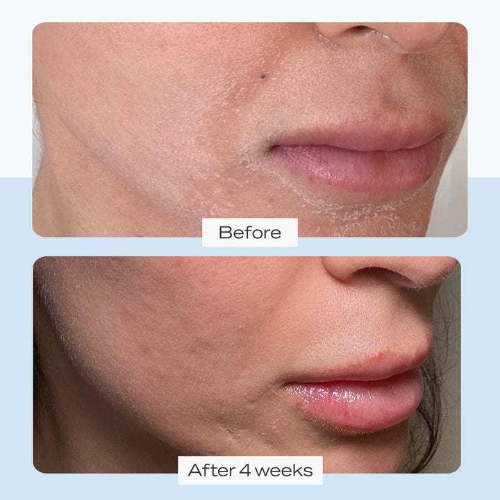 First Aid Beauty Ultra Repair Cream - 12.0 oz