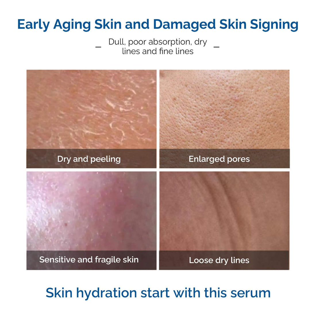 Ageless Elegance Argireline Serum - 11% Argireline Peptide Quality Fine Line Reducer, 1 Fl.Oz