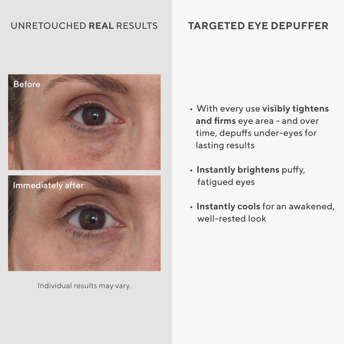 Murad Targeted Eye Depuffer - Visibly Brightens, Depuffs, and Firms Under-Eyes - Anti-Aging Eye Cream - Ginseng, Lily, and Caffeine Massage Away Puffiness and Under-Eye Bags - 0.5 FL OZ