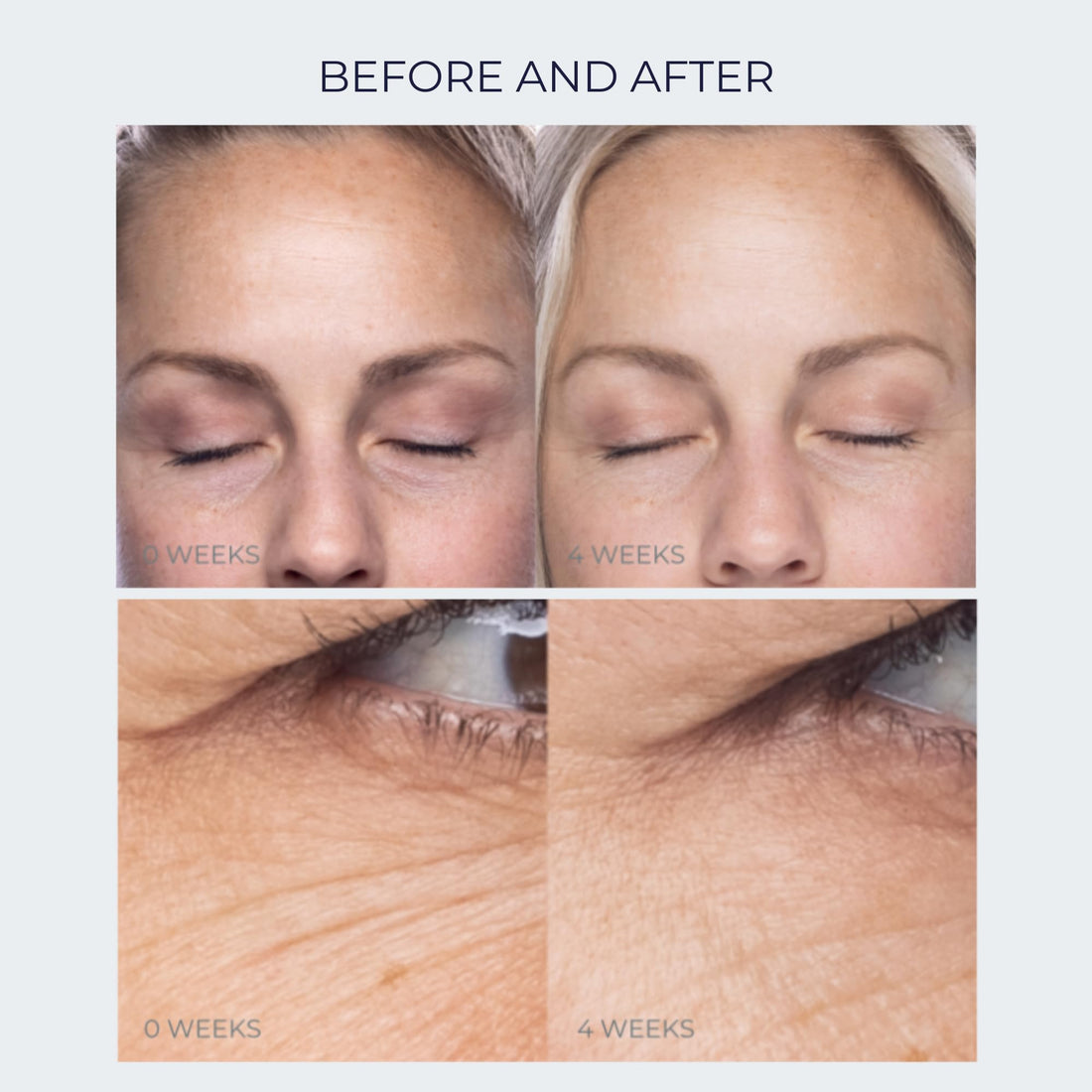 Anti-Aging Firming Peptide Eye Cream By Alana Mitchell - Look Younger, Reduce Wrinkles, Diminish Fine Lines & Erase Crow’s Feet - Deep Hydration & Nourishing - For Day & Night Use - Non Greasy .5oz