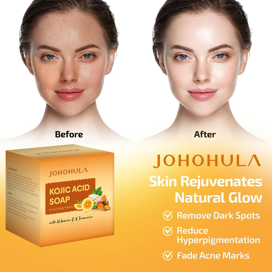 Johohula Kojic Acid Dark Spot Remover Soap Bars with Vitamin C, Retinol, Collagen, Turmeric - Smooth for Face and Body, Firm and smooth skin - 3 X 100g Bars