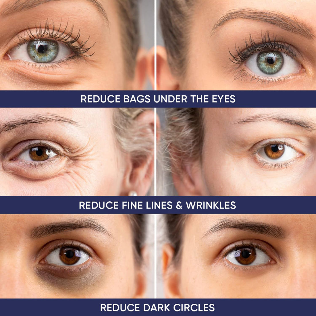 Instant Ageless Eye Cream – Anti Wrinkle Cream, Removes...