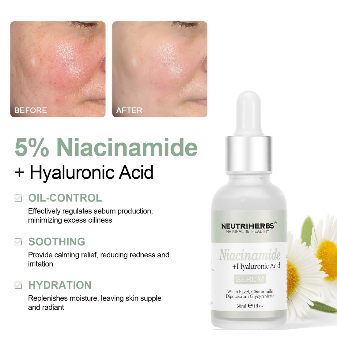 Neutriherbs 5% Niacinamide Serum for Face the Ordinary + HA,Effectively Work to Control Excess Facial Oil, Minimize the Pores and Prevent Breakouts, Best Niacinamide Serum For Oily Skin