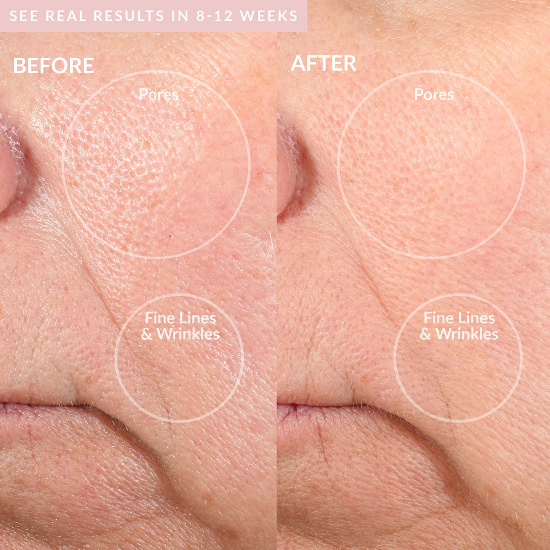 PMD Personal Microderm Pro - At-Home Microdermabrasion Machine with Kit for Face & Body - Exfoliating Crystals and Vacuum Suction for Fresh and Radiant Skin - High & Low Speed Options