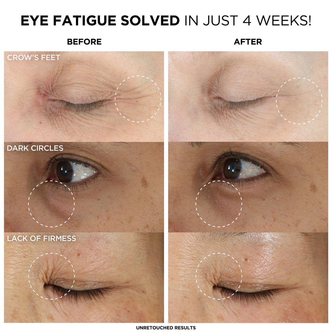 IT Cosmetics Confidence in an Eye Cream, Anti Aging Eye Cream for Dark Circles, Crow's Feet, Lack of Firmness & Dryness, 48HR Hydration with 2% Super Peptide Concentrate, for Day + Night