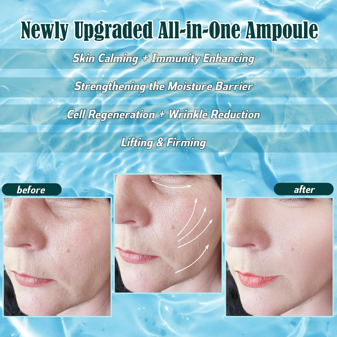 Hydro Ampoule-Korean Skin Care Serum for Microneedling Serum Ampoules for Face Starter Kit,dry effectivelyAll-purpose ampoule for Sensitive skin