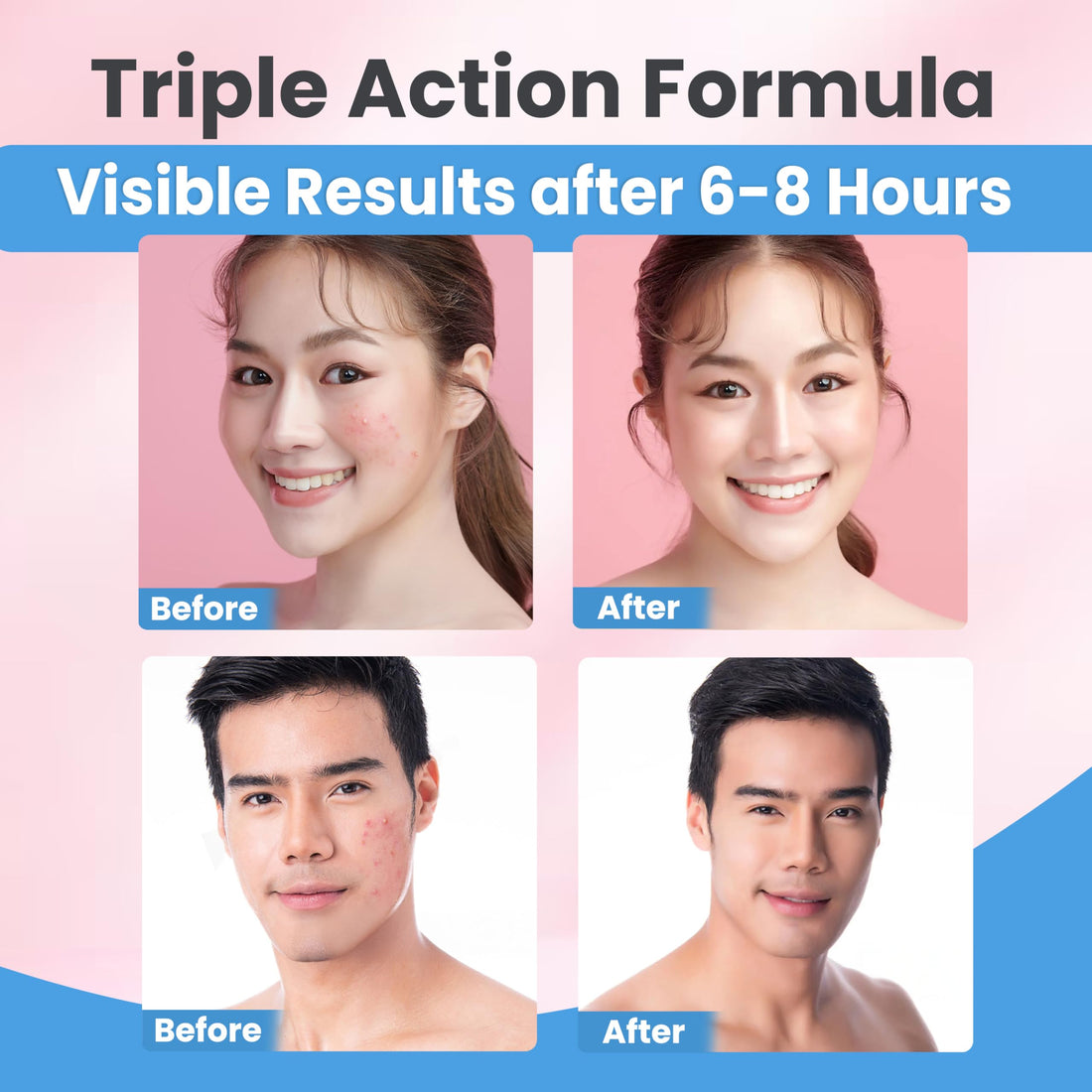 OHaai Invisible Hydrocolloid Pimple Patches for Face – Triple Action Acne Protection, Makeup Cover, 6X Advanced Absorption Technology, Waterproof & Sweatproof, Travel-Friendly (2 Sizes, 72 Count)