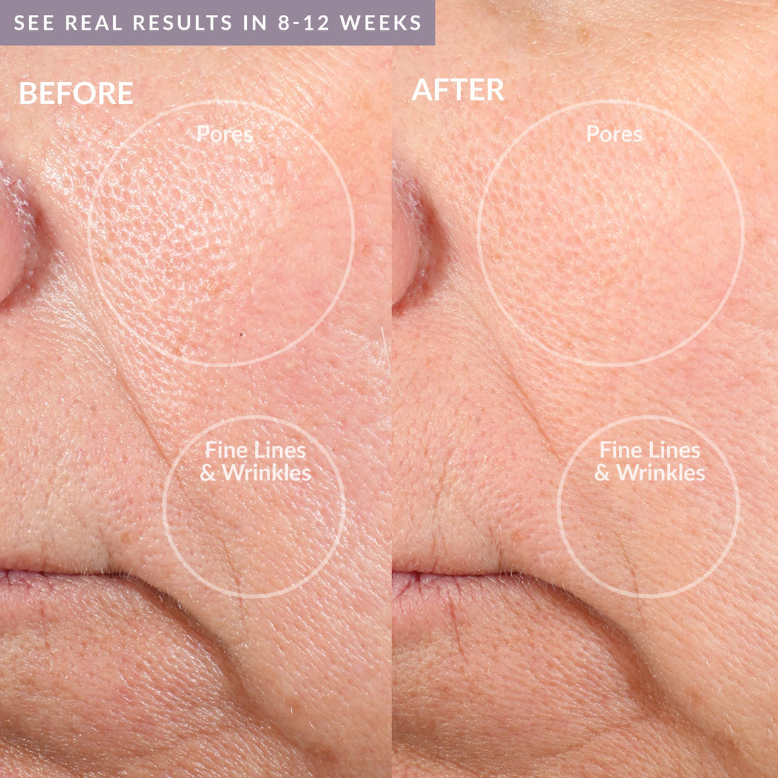 PMD Personal Microderm Pro - At-Home Microdermabrasion Machine with Kit for Face & Body - Exfoliating Crystals and Vacuum Suction for Fresh and Radiant Skin - High & Low Speed Options