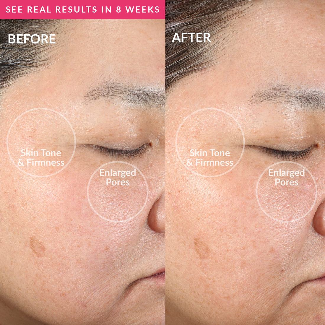 PMD Clean - Smart Facial Cleansing Device with Silicone Brush & Anti-Aging Massager - Waterproof - SonicGlow Vibration Technology - Lift, Firm, and Tone Skin on Face and Body - Pink