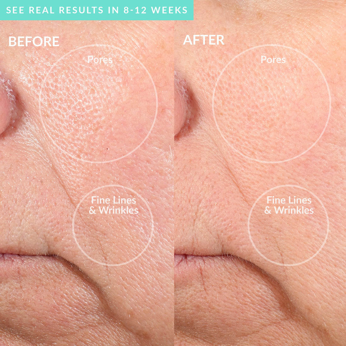 PMD Personal Microderm PRO (Teal)