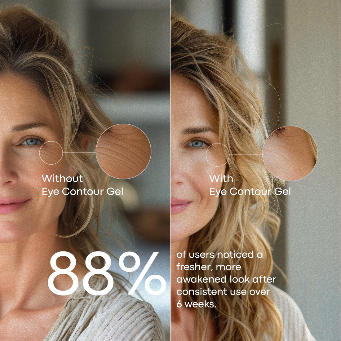 BIOSENS Under Eye Gel with Peptides, Niacinamide, Vitamin E, Eye Bags Treatment for Women & Dark Circles Treatment, Refreshes Tired look, Anti Aging, Fast-Absorbing, Airless 0.5 fl oz