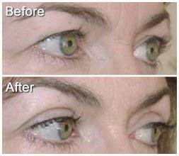 EyE-4-EyE Eye Magic Instant Eye Lift
