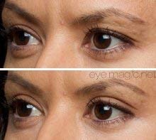 EyE-4-EyE Eye Magic Instant Eye Lift