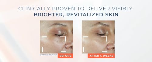 RoC Multi Correxion Revive + Glow Moisturizer with Vitamin C and SPF 30, 2 pack, 2.5 Fl OZ each