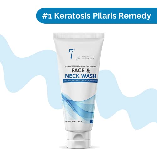 Microdermabrasion Facial Scrub & Face Exfoliator, Face & Neck Scrub and Soap - Face and Body Wash for KP and More - XLarge 4 Ounces - Moisturizing Facial Exfoliant for Dry Skin, Blackheads, Wrinkles,