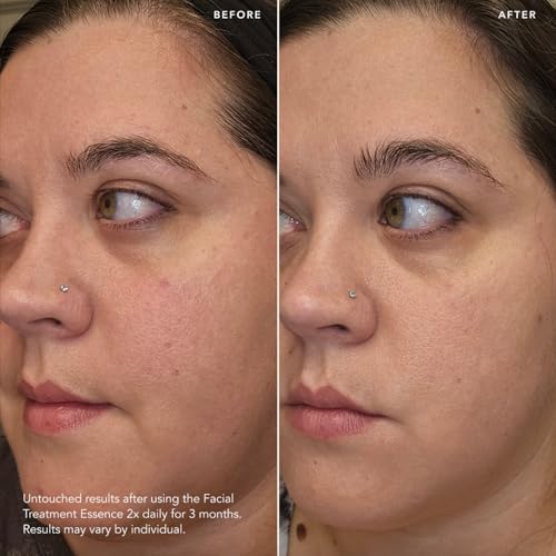 SK-II Facial Treatment Essence - Anti-Aging Essence Skincare to Help Reduce the Appearance of Fine Lines & Wrinkles - Visibly Refines Texture & Improves Firmness & Dark Spots (11.2 oz)