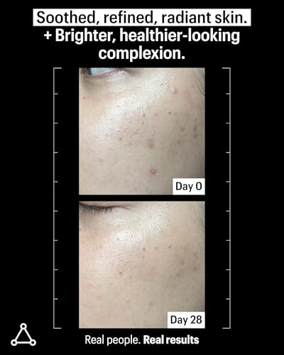 Allies of Skin 20% Vitamin C Serum | Daily Glow & Firming Face Serum | Lightweight Waterless Formula Treats Uneven Tone & Spots | Anti-Aging Support for Smooth, Radiant Skin (1 oz)