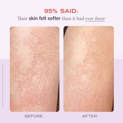 First Aid Beauty - KP Bump Eraser Body Scrub with 10% AHA, Keratosis Pilaris Exfoliator with Glycolic and Lactic acids, Helps Reduce Chicken Skin Bumps, Safe for Sensitive Skin, Strawberry Scent, 8 oz