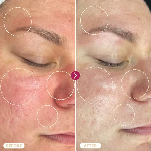 BASE LABORATORIES Hypochlorous Acid Spray for Face & Skin | 8 oz | Magic Facial Spray Daily Skin Repair Solution for Sensitive Skin, Redness, Irritations, Eczema, Acne. Hypochlrous HOCL Molecule Spray