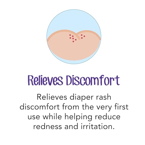 Desitin Daily Defense Baby Diaper Rash Cream with 13% Zinc Oxide Barrier Cream to Treat, Relieve & Prevent diaper rash, Hypoallergenic, Dye-, Phthalate- & Paraben-Free, Travel Size, 2 oz