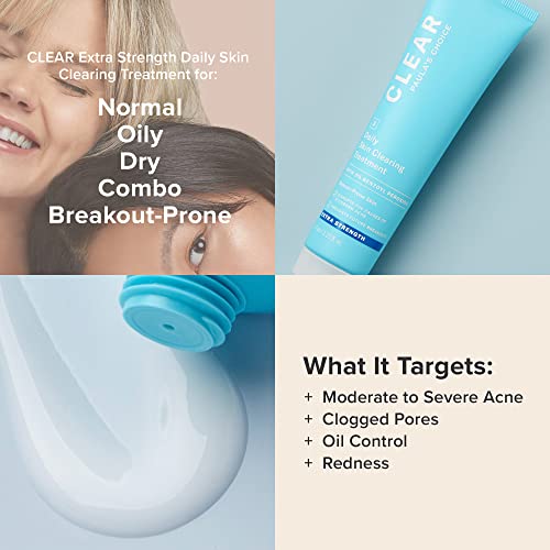 Paula's Choice CLEAR Daily Skin Clearing Treatment with Benzoyl Peroxide, Treats and Prevents Mild to Severe Acne & Breakouts, Fragrance-Free, 2.25 Fl. Oz.