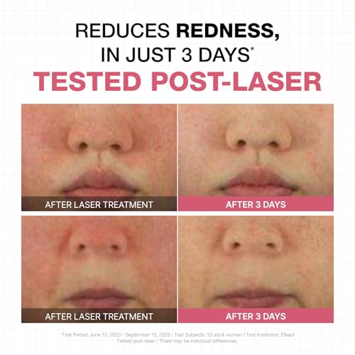 Physiogel Calming Relief Facial Cream, Reduces Redness in just 3 days, Hydration for Dry & Sensitive Skin, Korean skin care, Fragrance-Free, Non-Comedogenic, Dermatologist-Tested, Ceramide, Squalane.