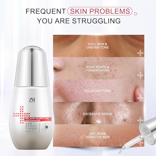 ZMbeauty Niacinamide Serum 10%, 377 1% Dark Spot Corrector, Vitamin C Face Serum for Uneven Skin Tone, Pores Reducer, Facial Soothing Moisturizer, Korean Skin Care 30ml/1.01 fl. oz