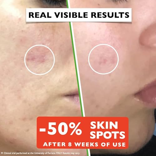 Vitamin C Serum For Face – Anti-Aging Facial Serum with Vitamin C, Hyaluronic Acid, Niacinamide, B5 & Vit E. Brightening Facial Formula for Dark Spots, Fine Lines, Wrinkles & Glowing Skin, 2 Fl Oz